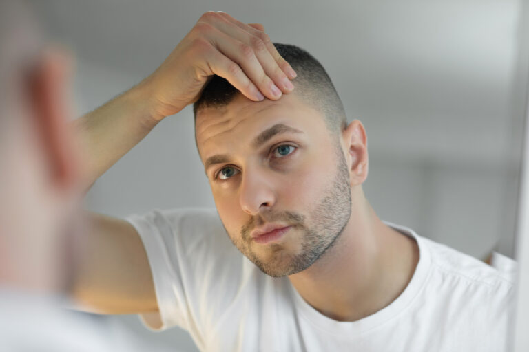 man checking hair loss in mirror